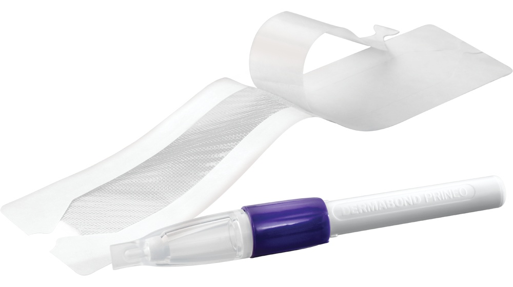 DERMABOND™ PRINEO™ Skin Closure System