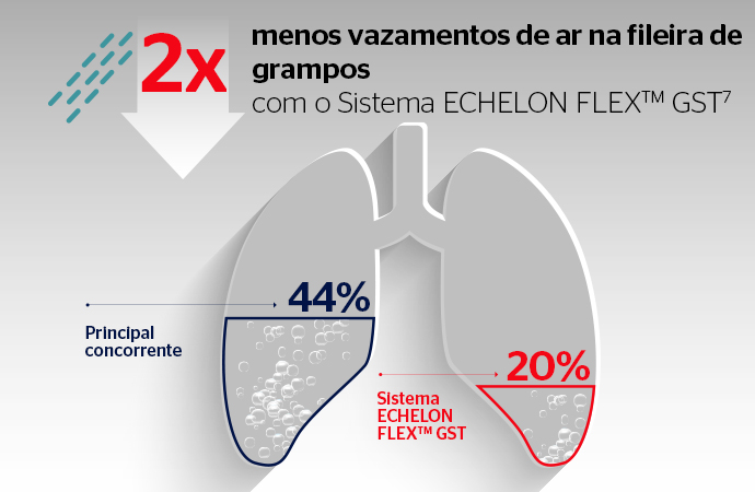 Modelo de pulmão fisiológico revela menos vazamentos de ar