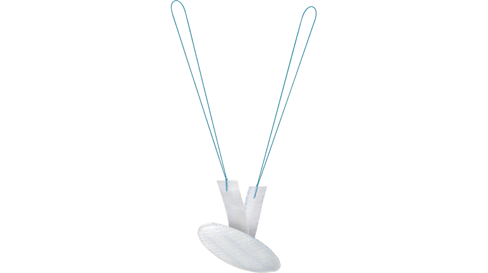 PROCEED® Ventral Patch
