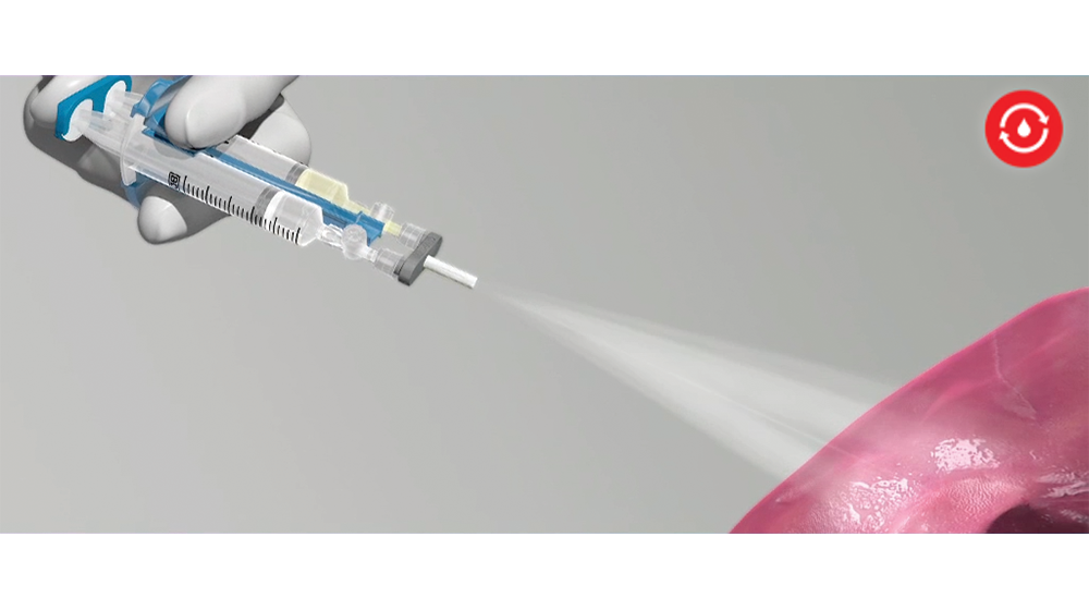 EVICEL® Fibrin Sealant (Human) Ethicon