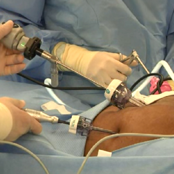 There are fewer than 1,000 Gynecologic oncologists in the U.S.