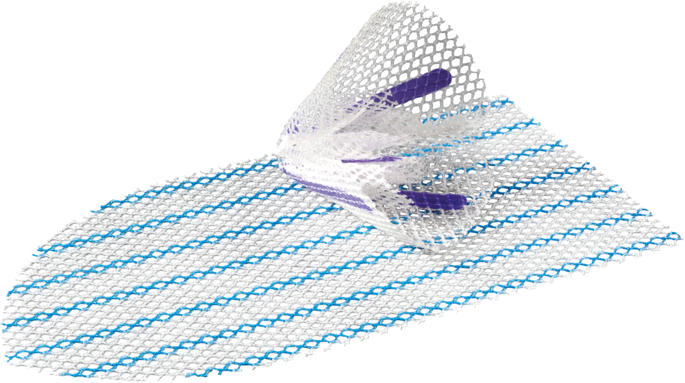 ULTRAPRO COMFORT PLUG™ Partially Absorbable Hernia Repair Device
